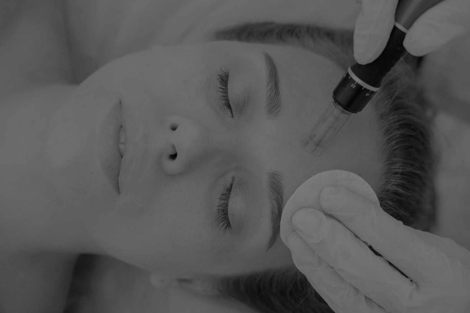 Nano-needling